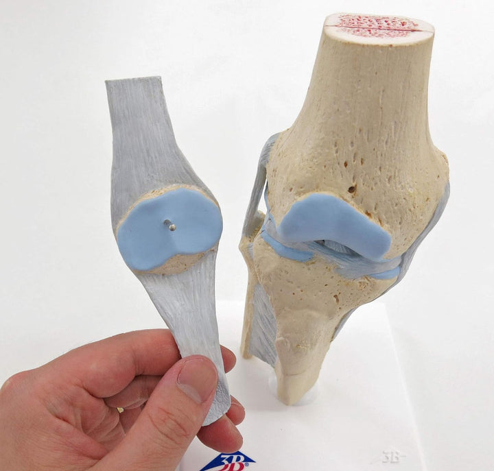 3B Scientific Menschliche Anatomie - Gelenkschnitt-Modell des Knies, 3-teilig + kostenlose Anatomie