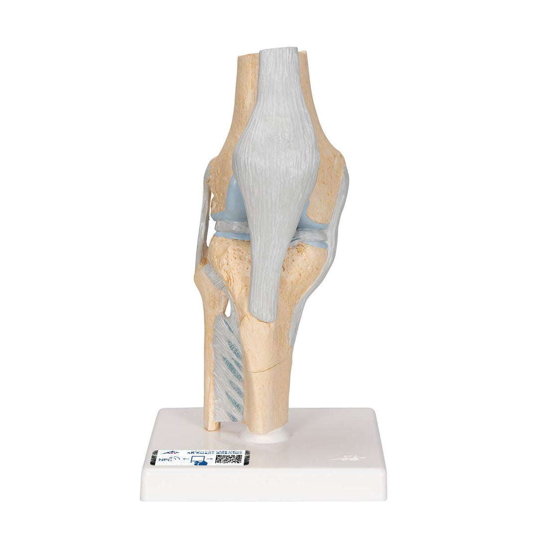 3B Scientific Menschliche Anatomie - Gelenkschnitt-Modell des Knies, 3-teilig + kostenlose Anatomie