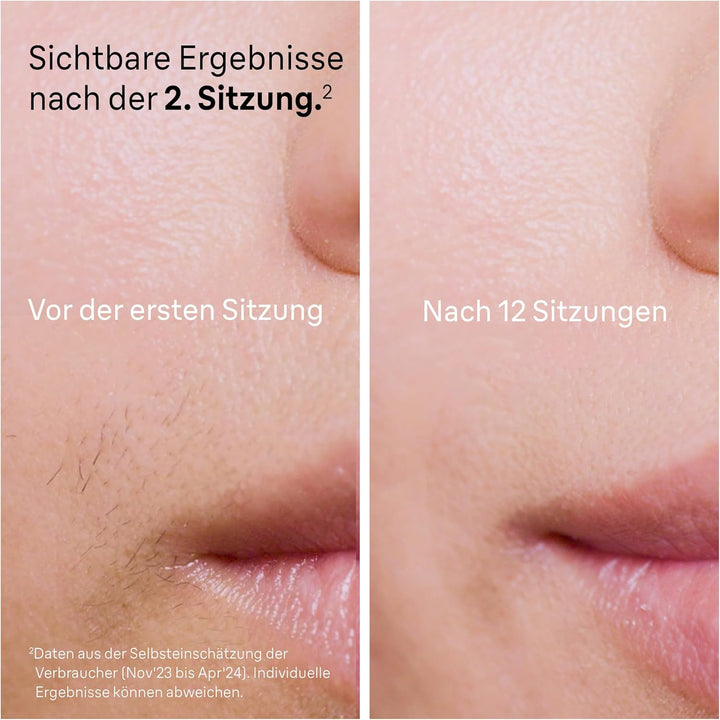Braun IPL Silk Expert Pro 5 Haarentfernungsgerät Damen/Herren, 2 Aufsätze, sichtbare Haarentfernung,
