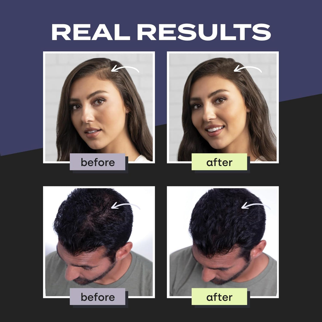 TOPPIK Hair Building Fibers Gray, 1er Pack (1 x 28 g)