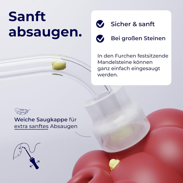 TONSI 2in1 Mandelstein Schröpfglas & Munddusche | Mandelstein Entferner Made in Germany | Mandeln sp