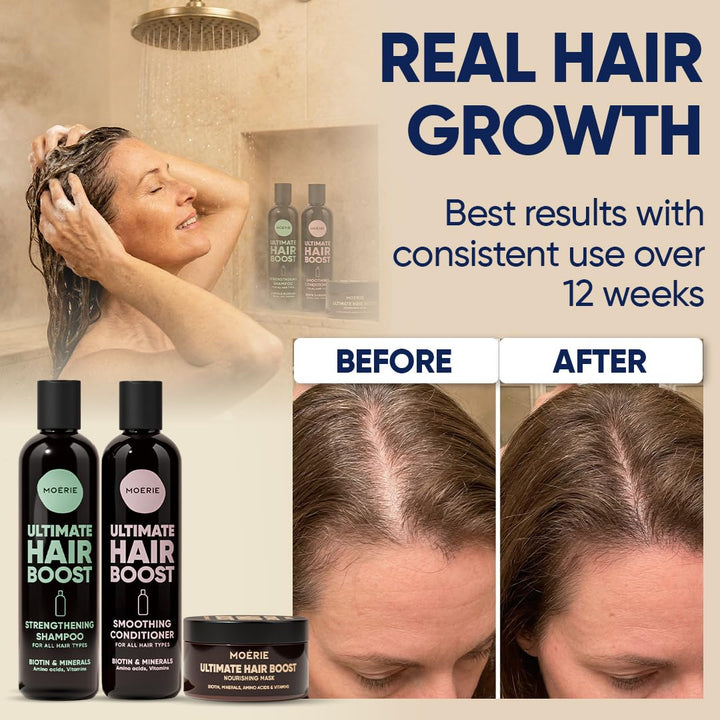 Moerie Mineralstoff-Shampoo Und Conditioner Plus Haarmasken-Paket – Das Ultimative Haarpflegeset – F