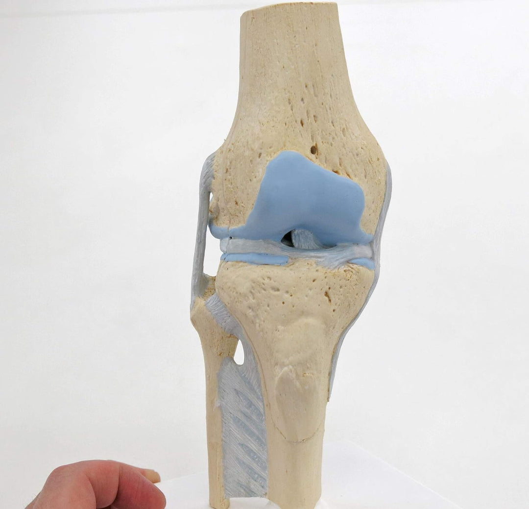 3B Scientific Menschliche Anatomie - Gelenkschnitt-Modell des Knies, 3-teilig + kostenlose Anatomie
