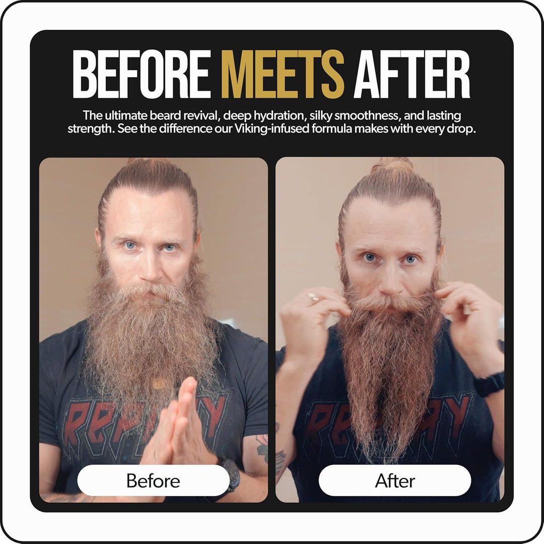 The Beard Struggle Bartöl Set Tag & Nacht – Bartpflege & Bartwuchsöl Bundle für Männer – Feuchtigkei