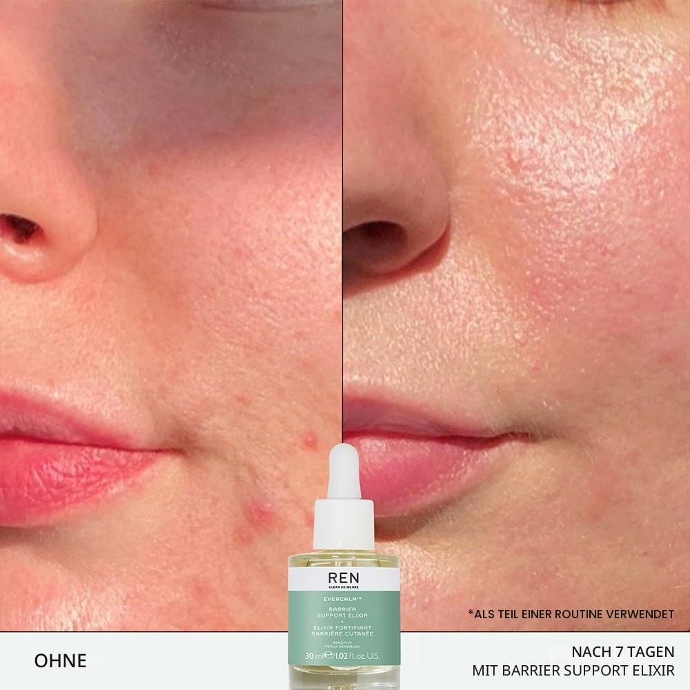 Ren - Evercalm Barrier Support Elixir 30 ml