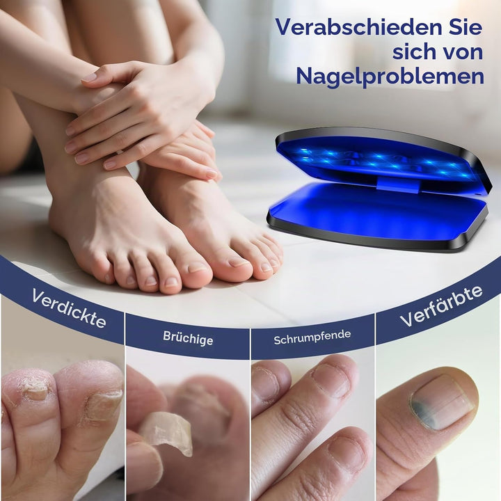 Upgrade Nagelpilz Lasergerät, 15 LED Tragbar & Wiederaufladbar per USB-C, 11 Blaulicht + 4 Infrarot,
