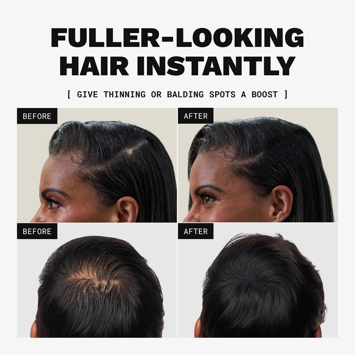 Toppik Haarfasern, Mittelbraun, natürlich gewonnene Fasern aus Keratin für voller aussehendes Haar 2