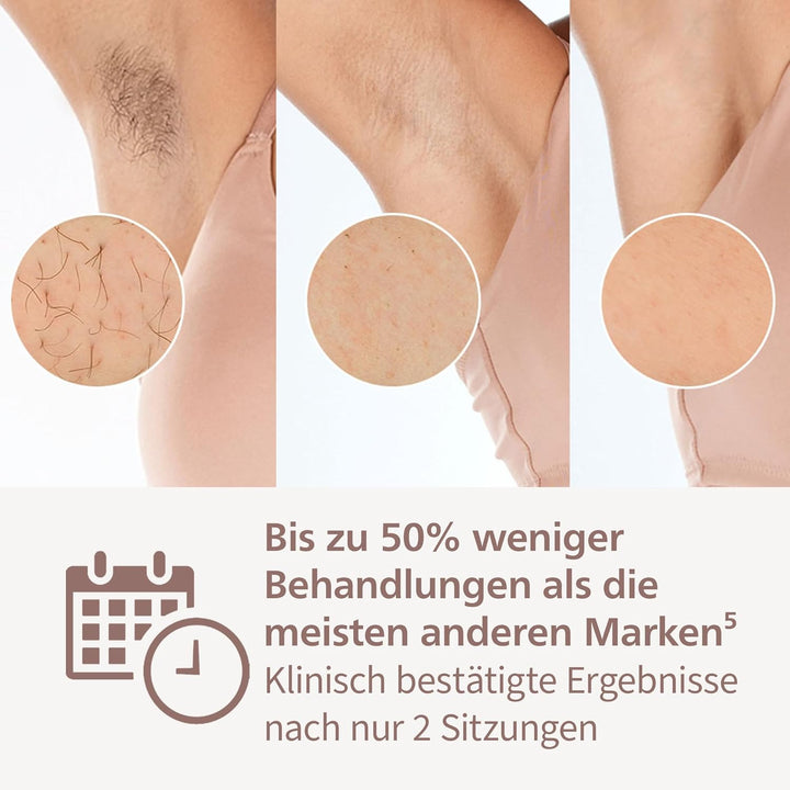 Philips Lumea IPL Prestige, 2 Aufsätze – Haarentfernungsgerät