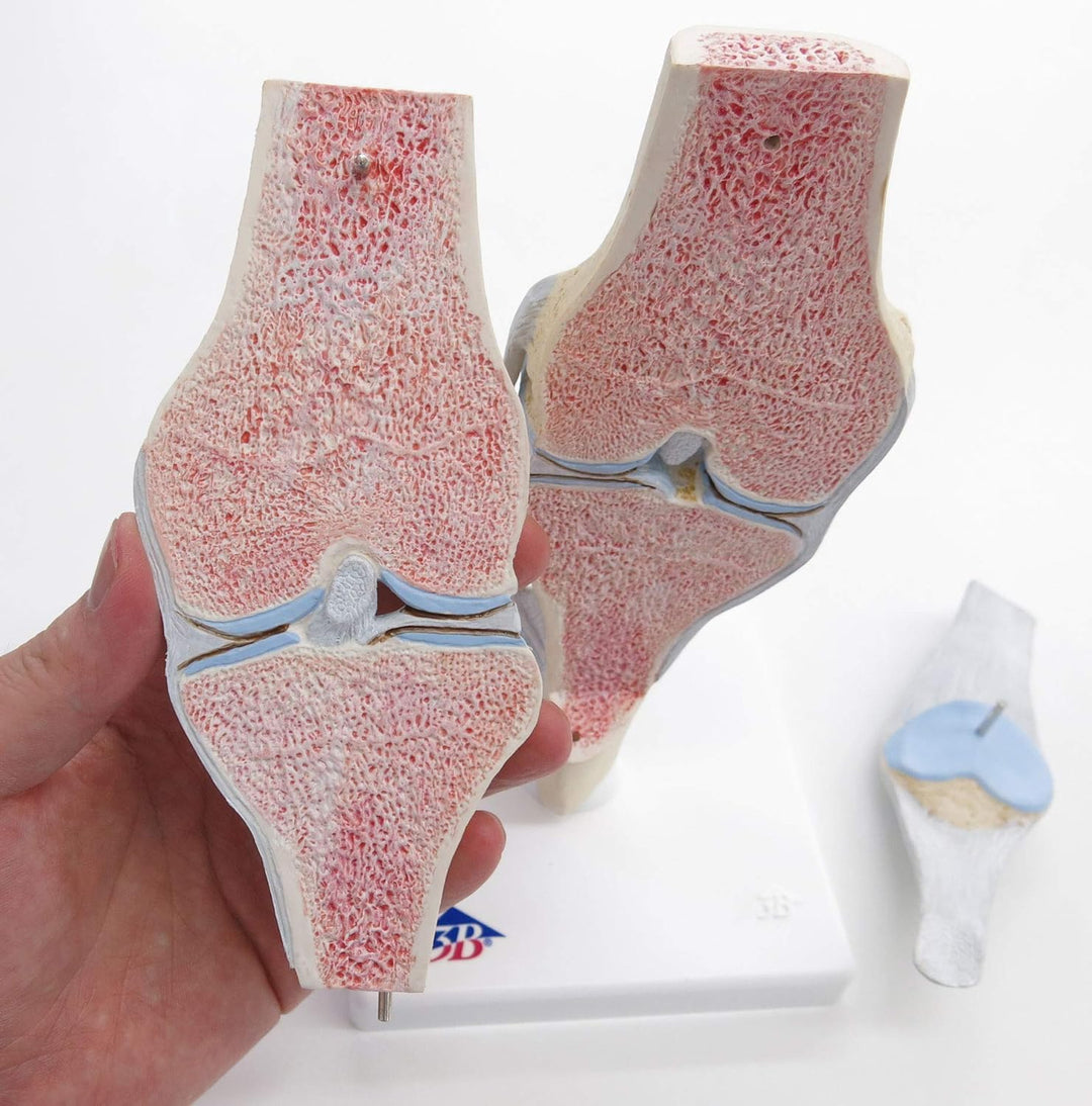 3B Scientific Menschliche Anatomie - Gelenkschnitt-Modell des Knies, 3-teilig + kostenlose Anatomie
